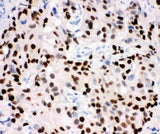 Anti-Progesterone Receptor/PGR Antibody Picoband® Boster Bio