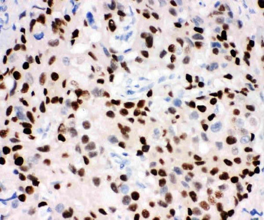 Anti-Progesterone Receptor/PGR Antibody Picoband® Boster Bio