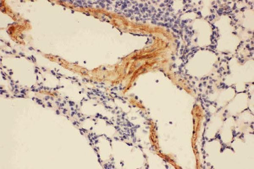 Anti-Adiponectin/ADIPOQ Antibody Picoband® Boster Bio