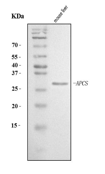 Anti-Serum Amyloid P/APCS Antibody Picoband® Boster Bio