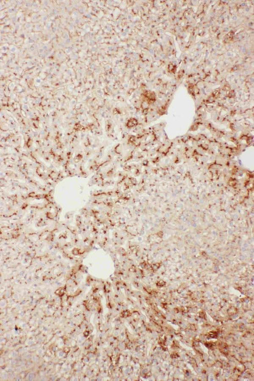 Anti-Serum Amyloid P/APCS Antibody Picoband® Boster Bio
