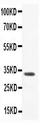 Anti-CCL3/Macrophage Inflammatory Protein 1 alpha Antibody Picoband® Boster Bio