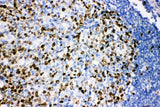 Anti-Ki67/MKI67 Antibody Picoband® Boster Bio