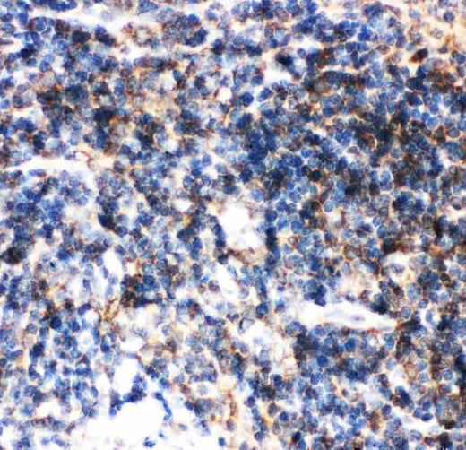 Anti-BID Antibody Picoband® Boster Bio