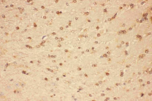 Anti-CNTF Antibody Picoband® Boster Bio
