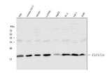 Anti-Cofilin/CFL1 Antibody Picoband® Boster Bio