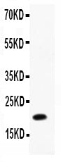 Anti-IL12 p40/IL12B Antibody Picoband® Boster Bio