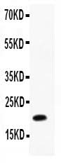 Anti-IL12 p40/IL12B Antibody Picoband® Boster Bio