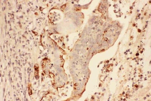 Anti-MMP7 Antibody Picoband® Boster Bio