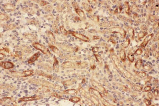 Anti-MMP7 Antibody Picoband® Boster Bio