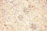 Anti-ACTH/POMC Antibody Boster Bio