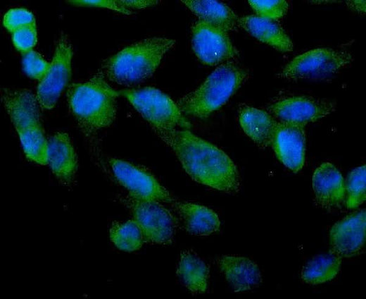 Anti-ARA9/AIP Antibody Picoband® Boster Bio