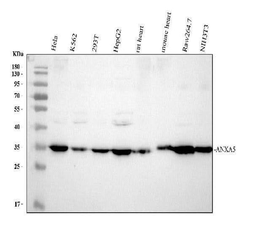Anti-Annexin V/ANXA5 Antibody Picoband® Boster Bio
