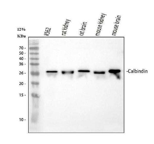 Anti-Calbindin/CALB1 Antibody Picoband® Boster Bio