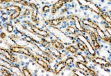 Anti-Cathepsin D/CTSD Antibody Picoband® Boster Bio