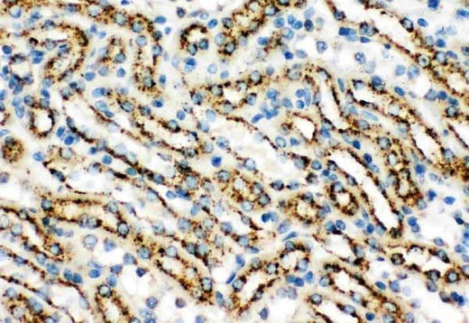 Anti-Cathepsin D/CTSD Antibody Picoband® Boster Bio