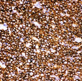 Anti-CD20/MS4A1 Antibody Picoband® Boster Bio
