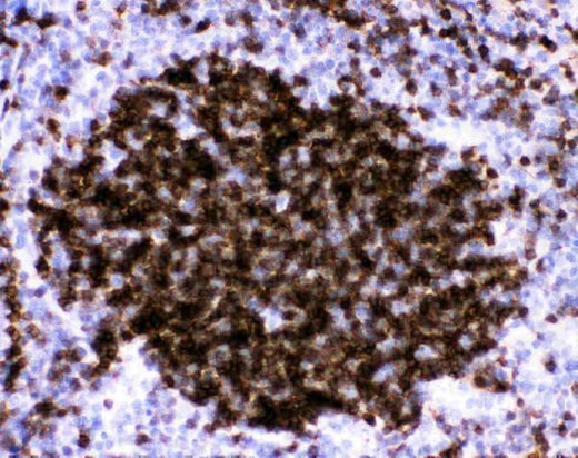 Anti-CD23/FCER2 Antibody Picoband® Boster Bio