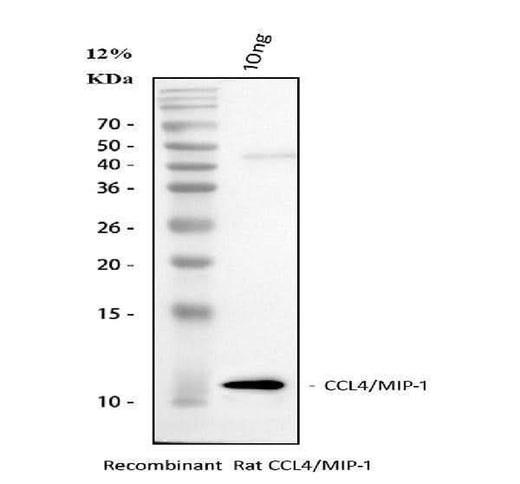 Anti-Macrophage Inflammatory Protein 1 beta/CCL4 Antibody Picoband® Boster Bio