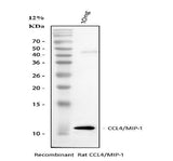 Anti-Macrophage Inflammatory Protein 1 beta/CCL4 Antibody Picoband® Boster Bio