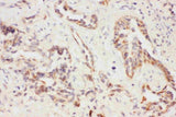 Anti-Eotaxin 3/CCL26 Antibody Picoband® Boster Bio