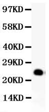 Anti-GDNF Antibody Picoband® Boster Bio