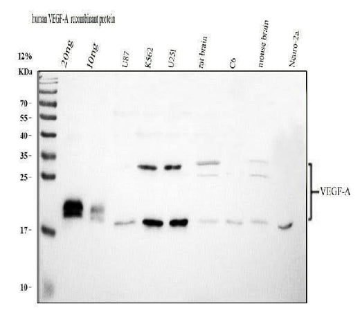 Anti-VEGF/VEGFA Antibody Picoband® Boster Bio
