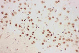 Anti-5 Lipoxygenase/ALOX5 Antibody Picoband® Boster Bio