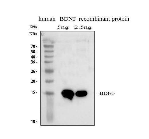 Anti-BDNF Antibody Picoband® Boster Bio