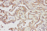 Anti-Galectin 3/LGALS3 Antibody Picoband® Boster Bio