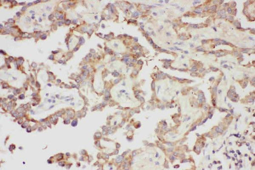 Anti-Galectin 3/LGALS3 Antibody Picoband® Boster Bio