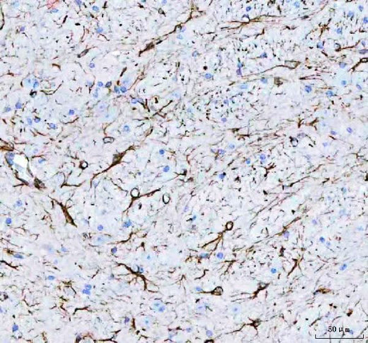 Anti-GFAP Antibody Picoband® Boster Bio