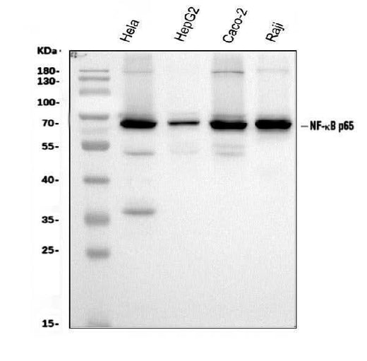 Anti-NF-kB p65/RELA Antibody Picoband® Boster Bio