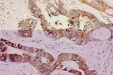Anti-Hsp90 alpha/HSP90AA1 Antibody Picoband® Boster Bio
