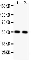 Anti-Glucose Transporter GLUT4/SLC2A4 Antibody Picoband® Boster Bio