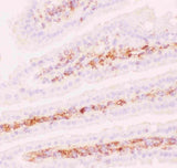 Anti-P Glycoprotein/ABCB1 Antibody Boster Bio