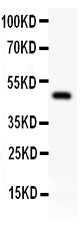Anti-alpha 1 Catenin/CTNNA1 Antibody Picoband® Boster Bio