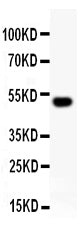 Anti-RUNX2 Antibody Picoband® Boster Bio