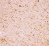Anti-SIRT2 Antibody Picoband® Boster Bio