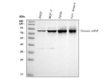 Anti-gamma Catenin/JUP Antibody Picoband® Boster Bio