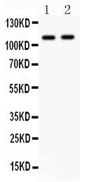 Anti-CARD4/NOD1 Antibody Picoband® Boster Bio