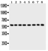 Anti-P2X2/P2RX2 Antibody Picoband® Boster Bio