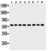 Anti-P2X2/P2RX2 Antibody Picoband® Boster Bio