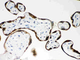 Anti-PAPP A/PAPPA Antibody Picoband® Boster Bio
