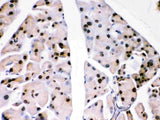 Anti-PARK7/DJ1 Antibody Picoband® Boster Bio