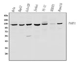 Anti-PARP/PARP1 Antibody Picoband® Boster Bio