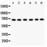 Anti-PKC iota/PRKCI Antibody Picoband® Boster Bio
