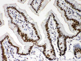 Anti-Nucleophosmin/NPM1 Antibody Picoband® Boster Bio
