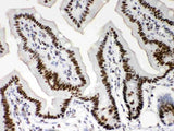 Anti-Nucleophosmin/NPM1 Antibody Picoband® Boster Bio