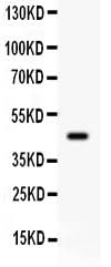 Anti-beta 2 Adrenergic Receptor/ADRB2 Antibody Picoband® Boster Bio